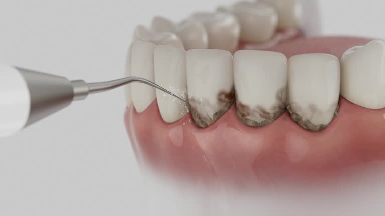 Trusted Dental Implants service in Des Arc, AR - Dentist Open Now